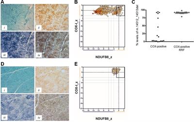 Novel MT-ND Gene Variants Causing Adult-Onset Mitochondrial Disease and Isolated Complex I Deficiency